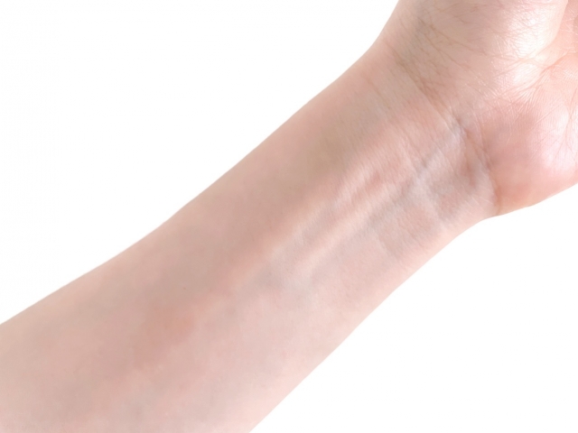 アロエのパッチテスト